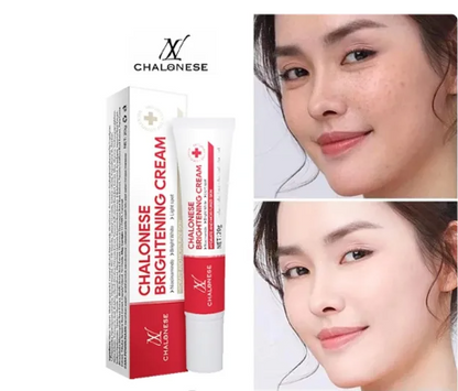 Chalonese Brightening Cream – Buy 1 Get 1 Free