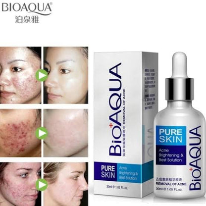 Bioaqua Acne Removal Serum