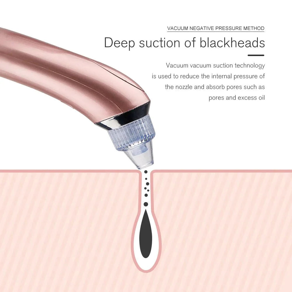 Blackheads Remover & Pore Cleaner